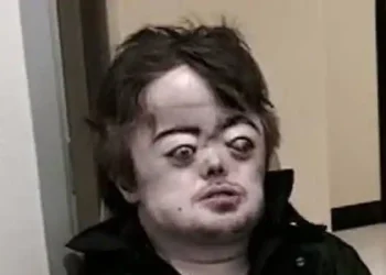 Brian Peppers: Das Rätsel hinter dem Mann mit dem markanten Gesicht