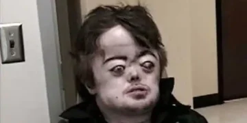 Brian Peppers: Das Rätsel hinter dem Mann mit dem markanten Gesicht